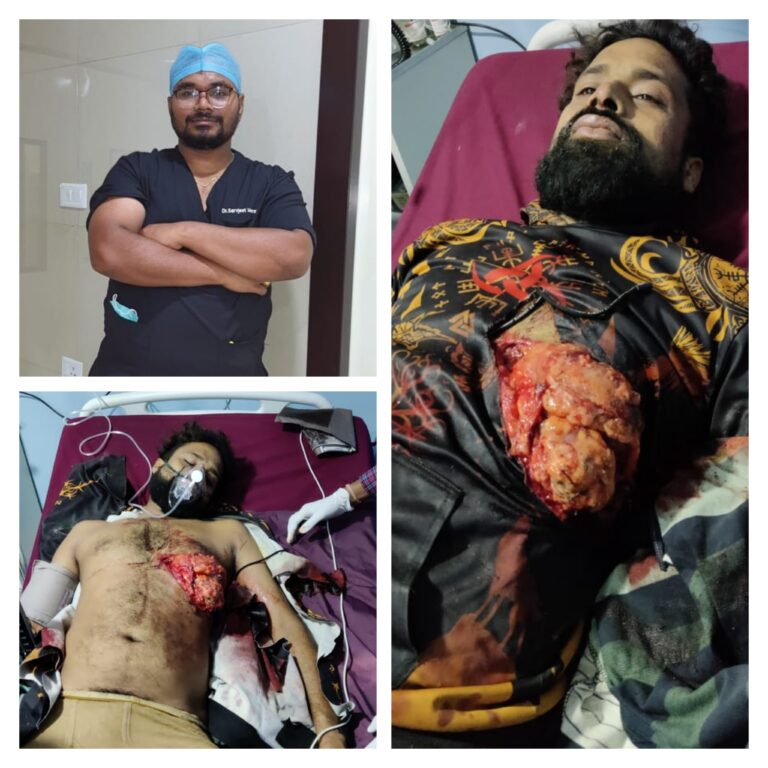 *मवेशी के हमले से गंभीर रूप से घायल युवक को न्यू वंदना हॉस्पिटल डॉक्टरों ने दिया जीवन दान*