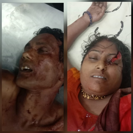 *जतिया तालाब क्षेत्र में फैली सनसनी दोहरे मर्डर केस का आरोपी तत्काल पुलिस की गिरफ्त में*