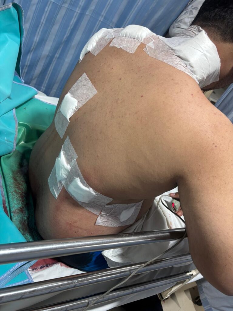 *लखीराम ऑडिटोरियम के पास खूनी झड़प: कांग्रेस नेता त्रिलोक श्रीवास के बेटे पर चाकू से हमला, हालत गंभीर*